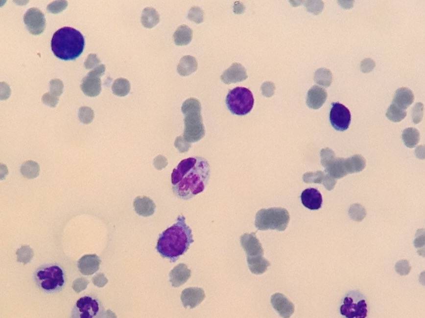 hepatozoon sp