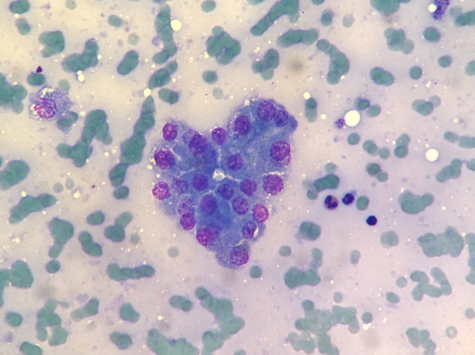 coeur d'hépatocytes
