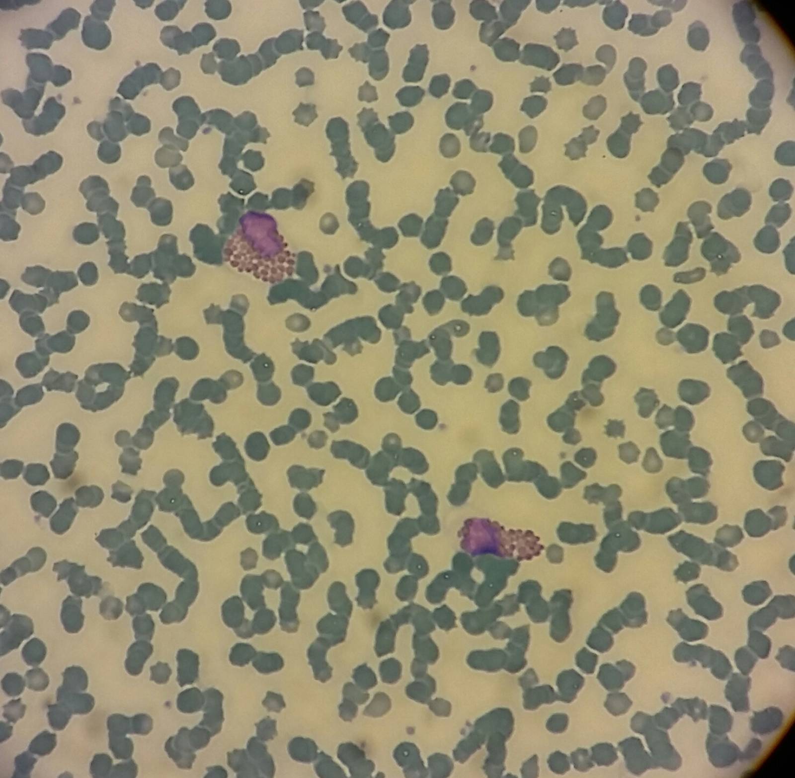 Eosinophiles chez le cheval, Vet'Analys à hyères