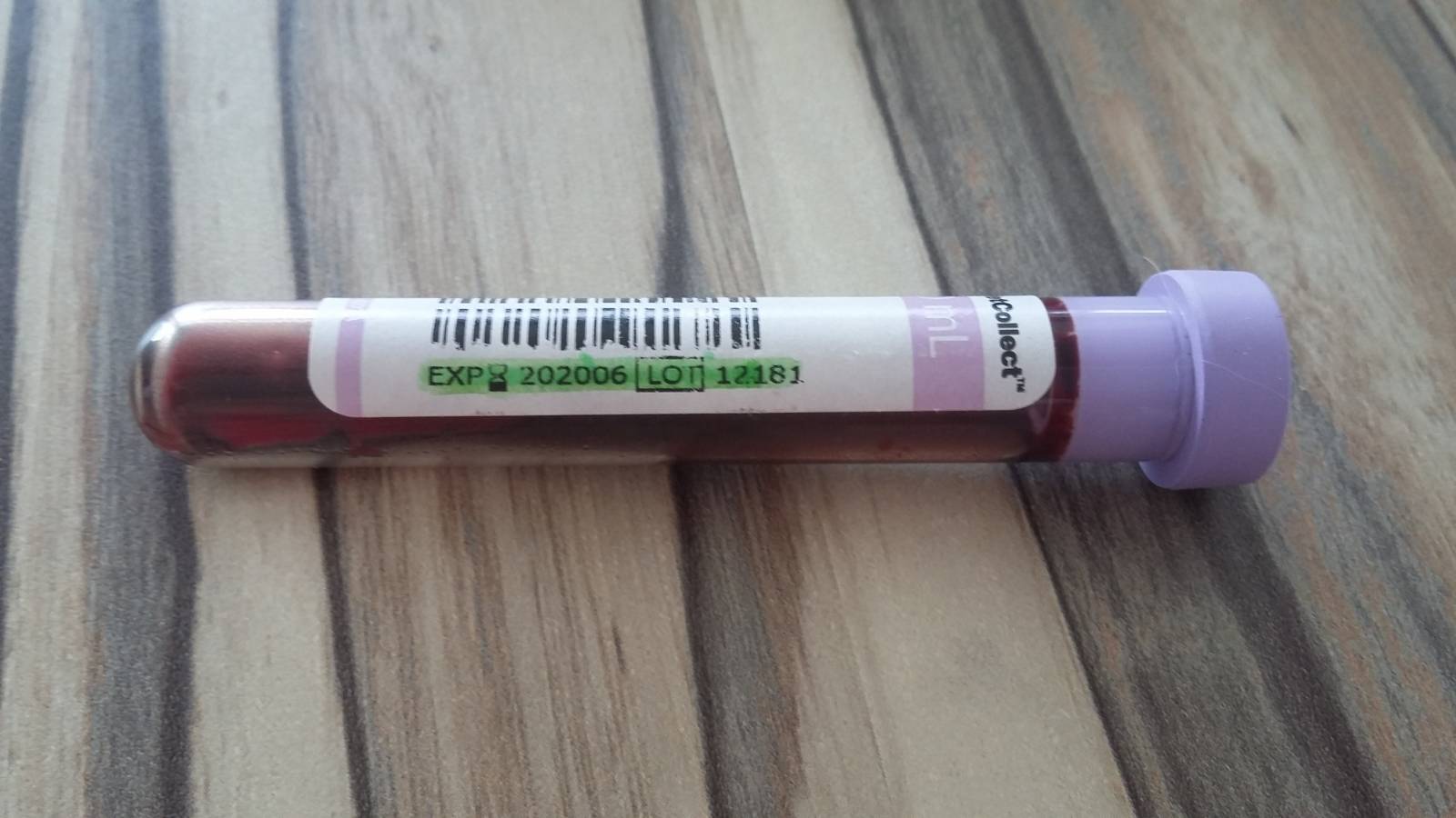 tube EDTA perimé au laboratoire vet'analy à hyères