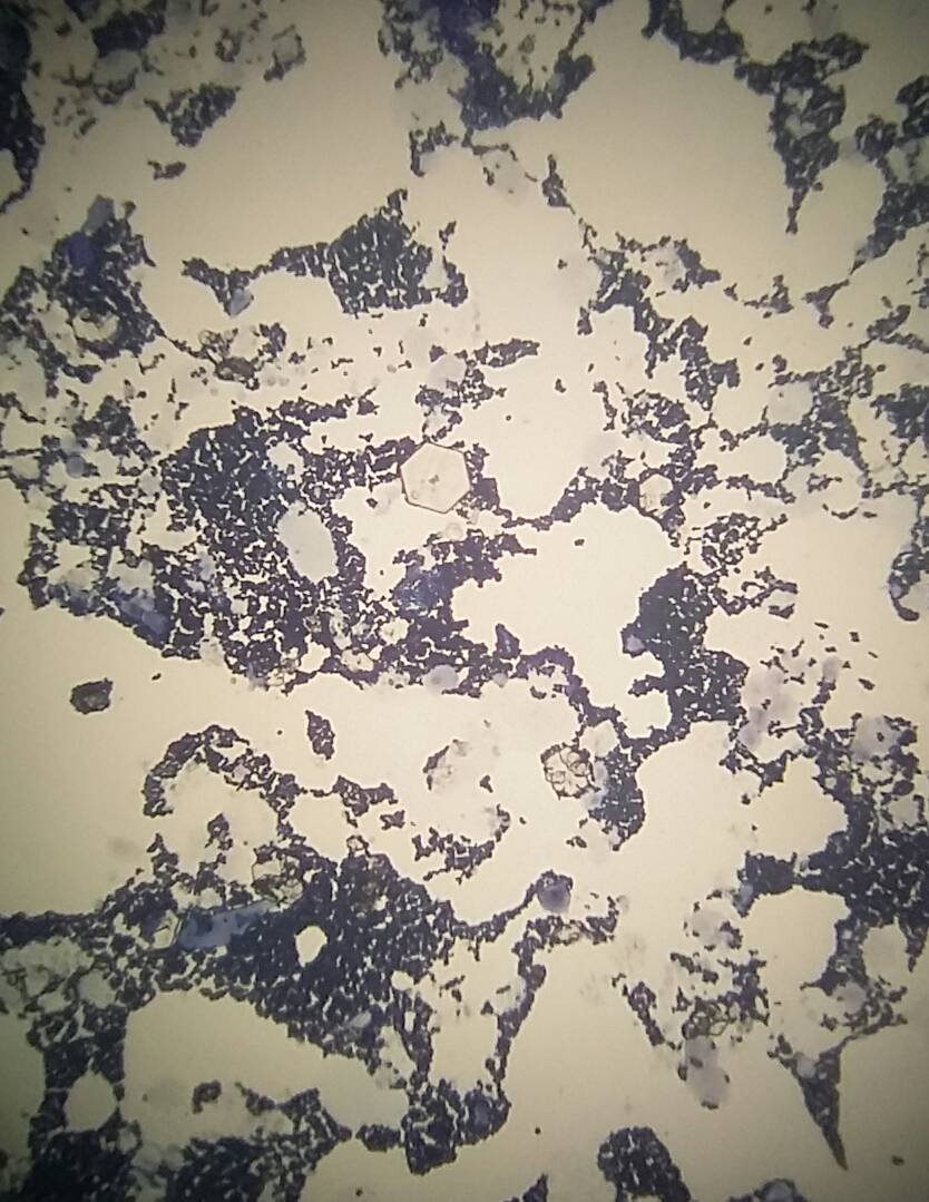 cristaux de cystine au laboratoire vet'analys à hyères