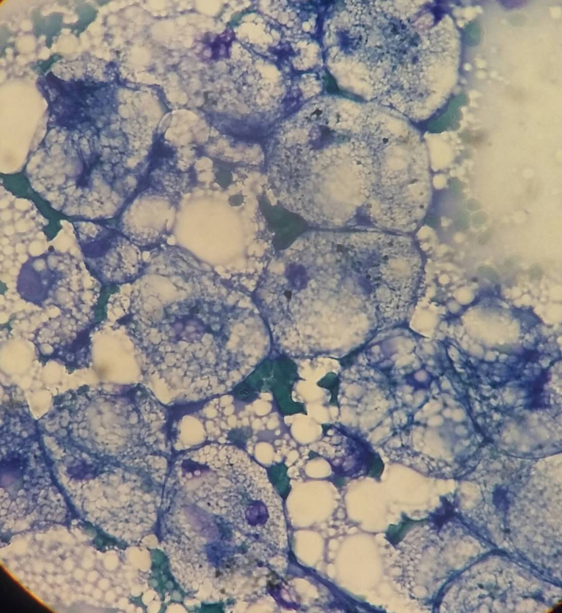 lipidose hépatique chez un chat par le laboratoire VET'ANALYS à hyères