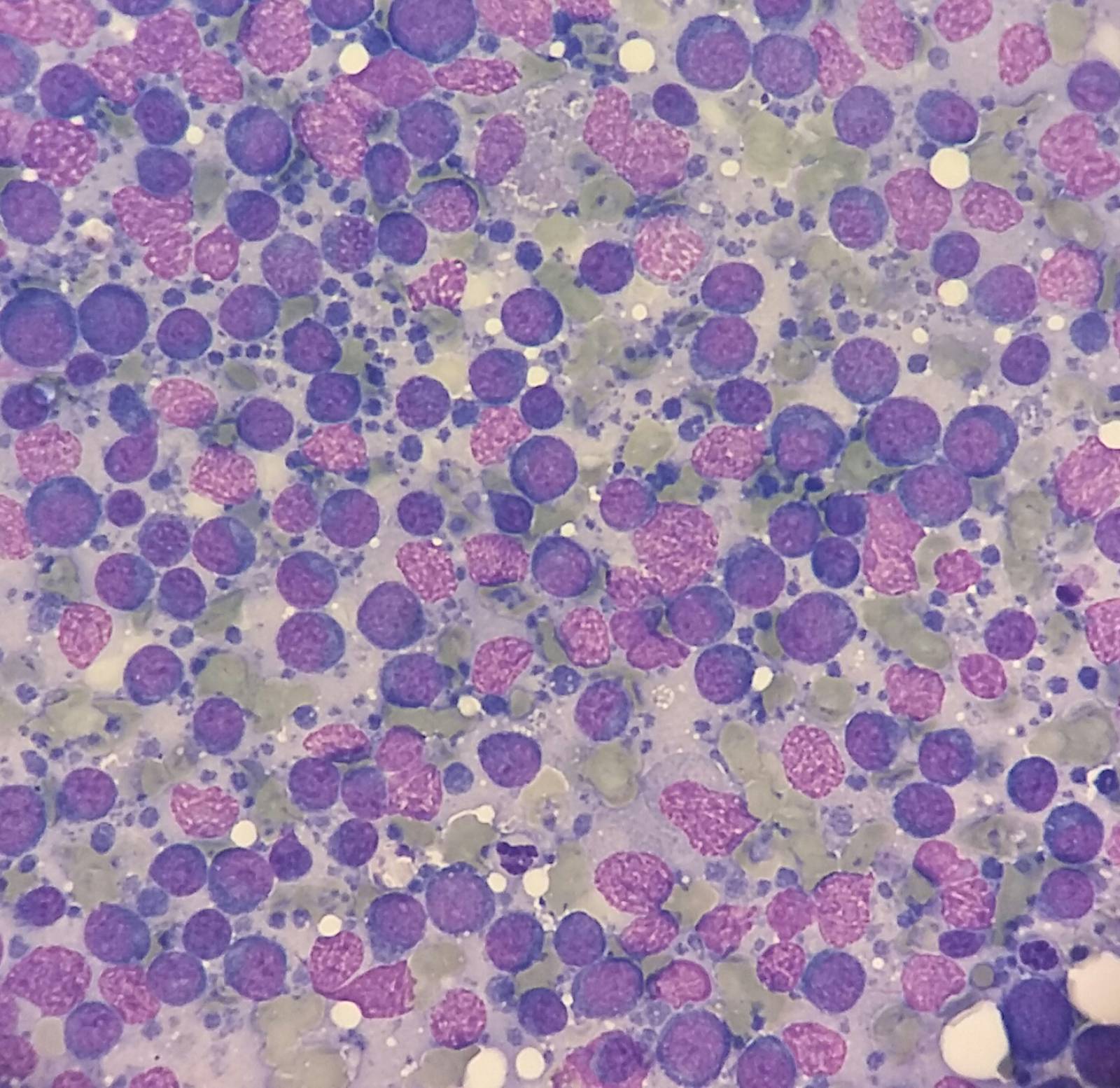 lymphome centroblastique par le laboratoire VET'ANALYS à hyères 83
